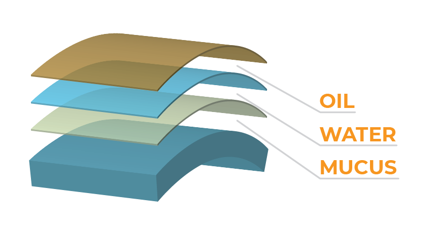 Healthy Eye Vs An Eye With Glaucoma